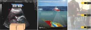 Ultrasound and ultrasonic distance measurement